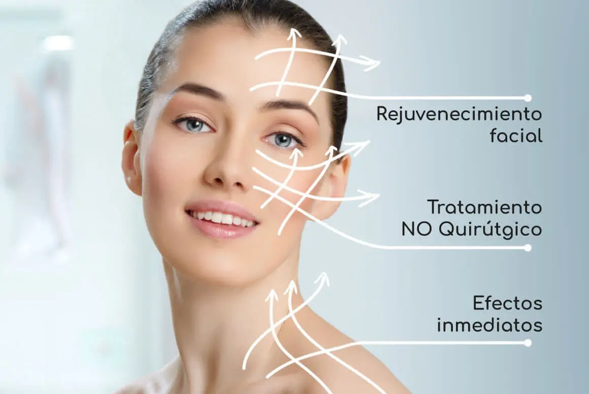 Hilos Tensores - Dr. Andrés Cordero