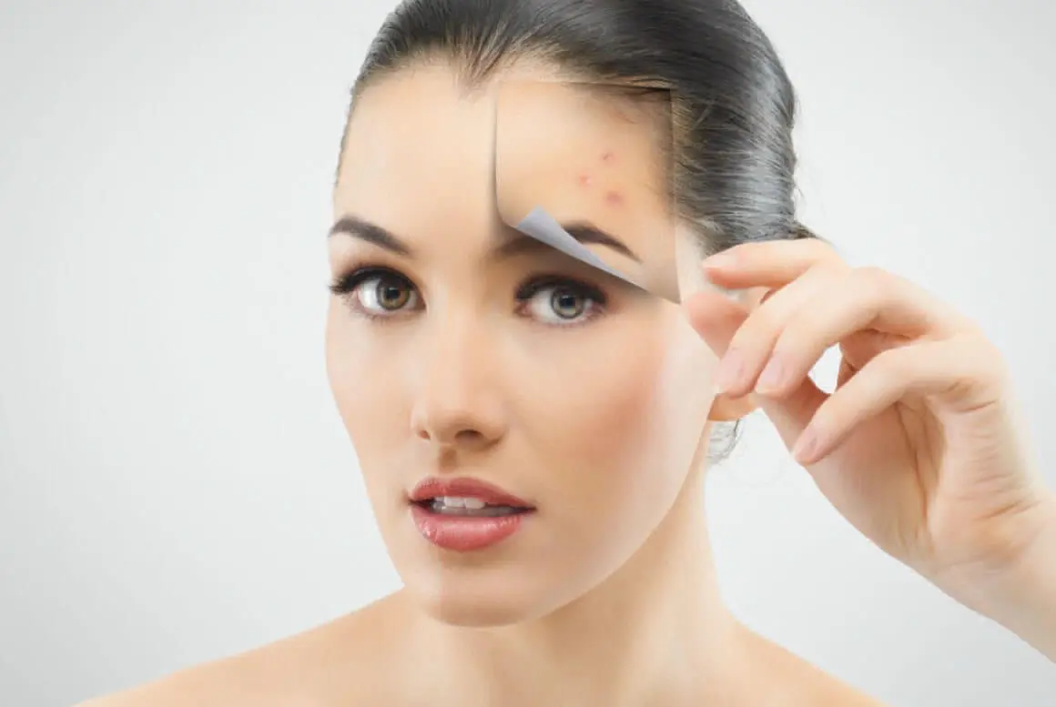 Microdermoabrasión - Dr. Andrés Cordero