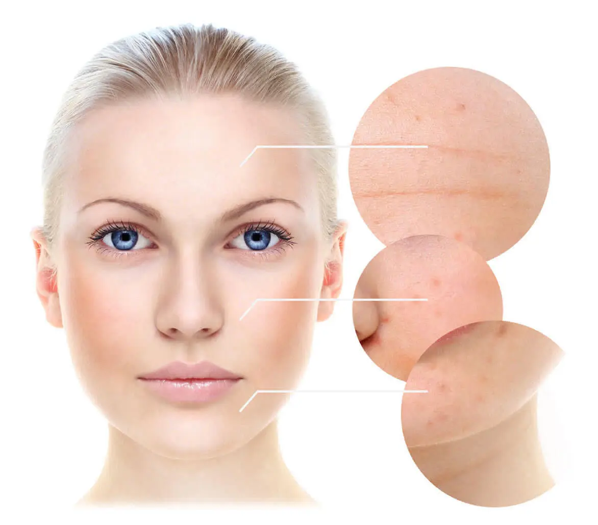 Plasma rico en plaquetas - Dr. Andrés Cordero