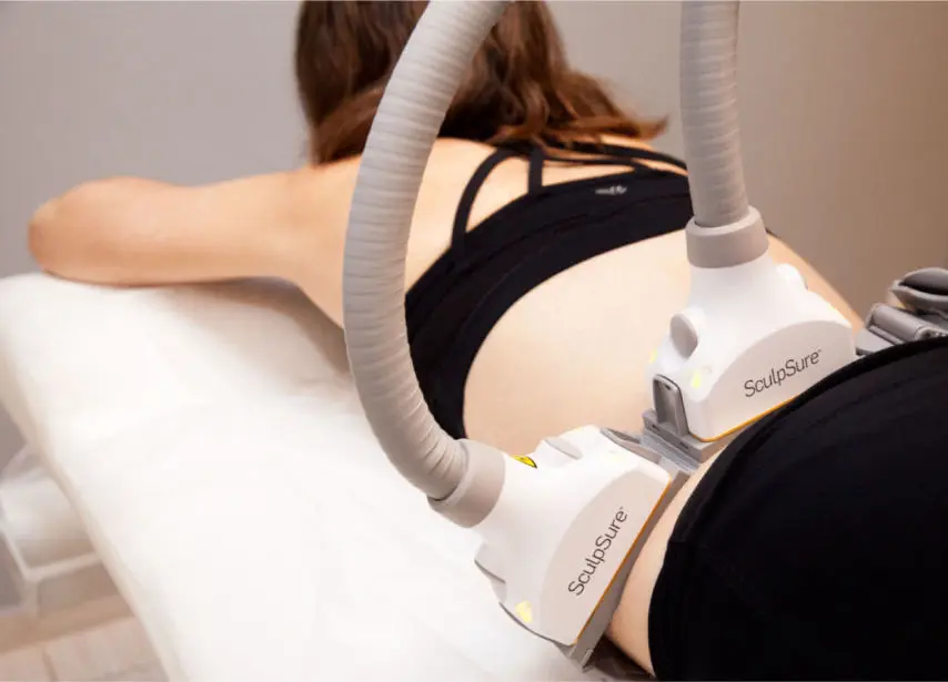 SculpSure - Dr. Andrés Cordero